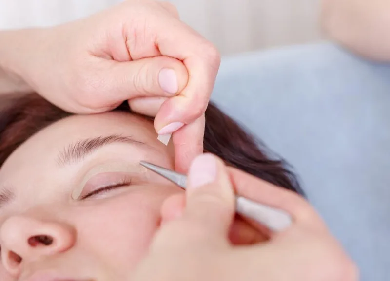 Co to jest Blepharoplastyka?
