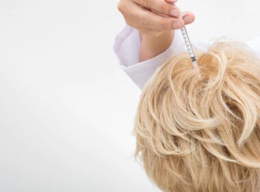 Ile przeszczepów jest potrzebnych do przeszczepu włosów?